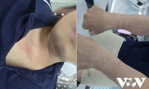 Lãnh đạo VOV Giao thông: 'Việc còng tay phóng viên đang tác nghiệp là bất thường'