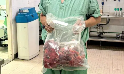 Lần đầu tiên tại Việt Nam: Cắt bỏ hai thận đa nang nặng gần 10kg, ghép thận thành công trong một ca mổ