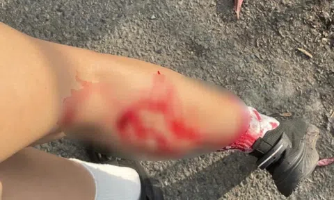 Khỉ hoang cắn người ở Vũng Tàu