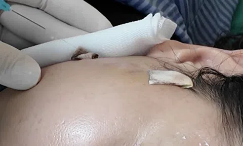 Đón Tết chưa kịp đẹp, người phụ nữ 40 tuổi "vỡ mộng" vì sự cố bất ngờ