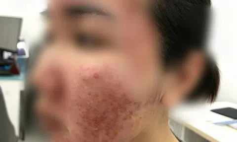 Cơn ác mộng của thiếu nữ chỉ sau vài giờ được mời làm đẹp cấp tốc đón Tết