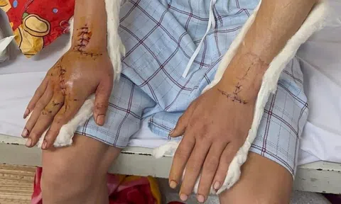 Tin mới vụ nhóm đối tượng chém người về quê ăn Tết