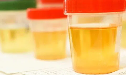 Niệu liệu pháp sống lại