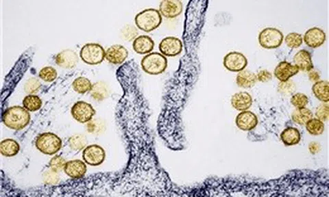 Những điều cần biết về virus Hanta