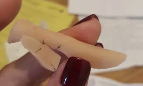 Ham làm đẹp giá rẻ, chị em “khóc ròng” vì “tiền mất, tật mang”