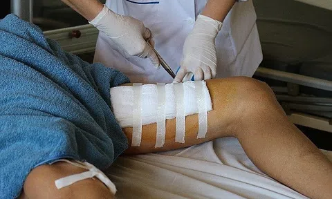 Bình rượu 20 lít phát nổ, một người bị đứt cơ chân