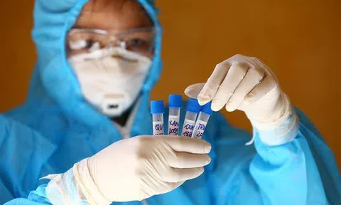 Sáng 9/8, Việt Nam có thêm 2 ca mắc mới COVID-19, trong đó 1 ca tại Hà Nội